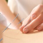 Acupunctures Ability To Reduce Pain Fb.jpg