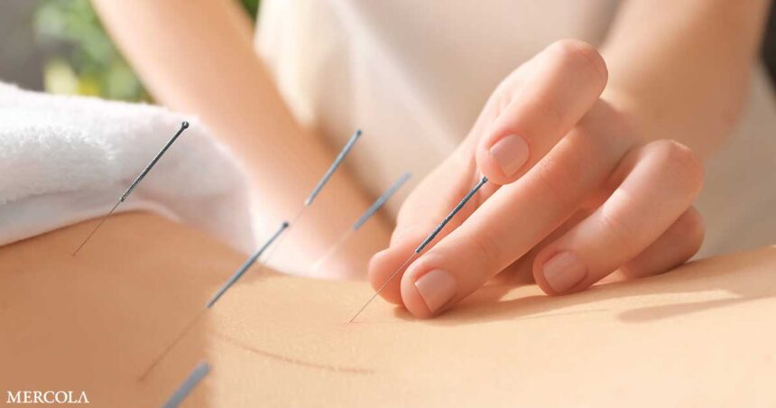 Acupunctures Ability To Reduce Pain Fb.jpg